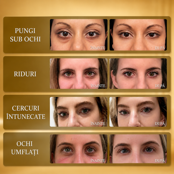 Patch-uri cu Colagen pentru Ochi Korean Cube™