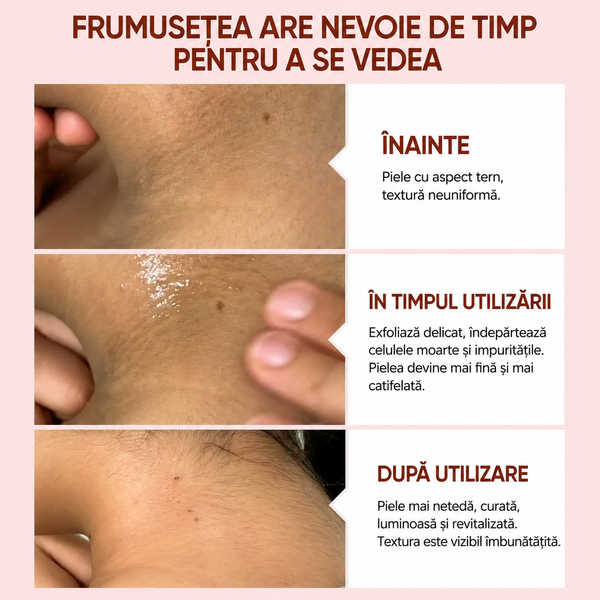 Gel Exfoliant Purificator