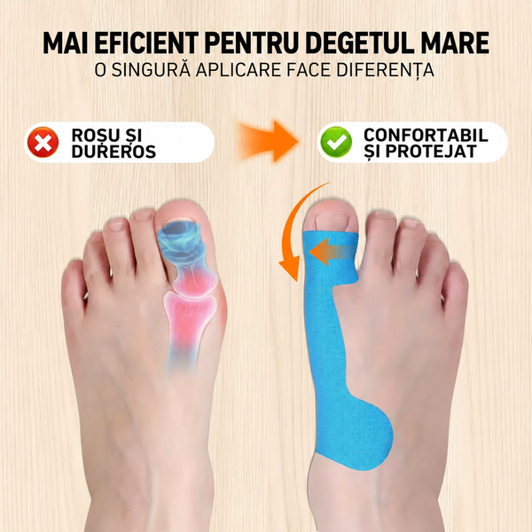 BunionFlex™ – Set 10 plasturi pentru monturi