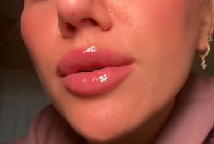 lip3 (1).avif